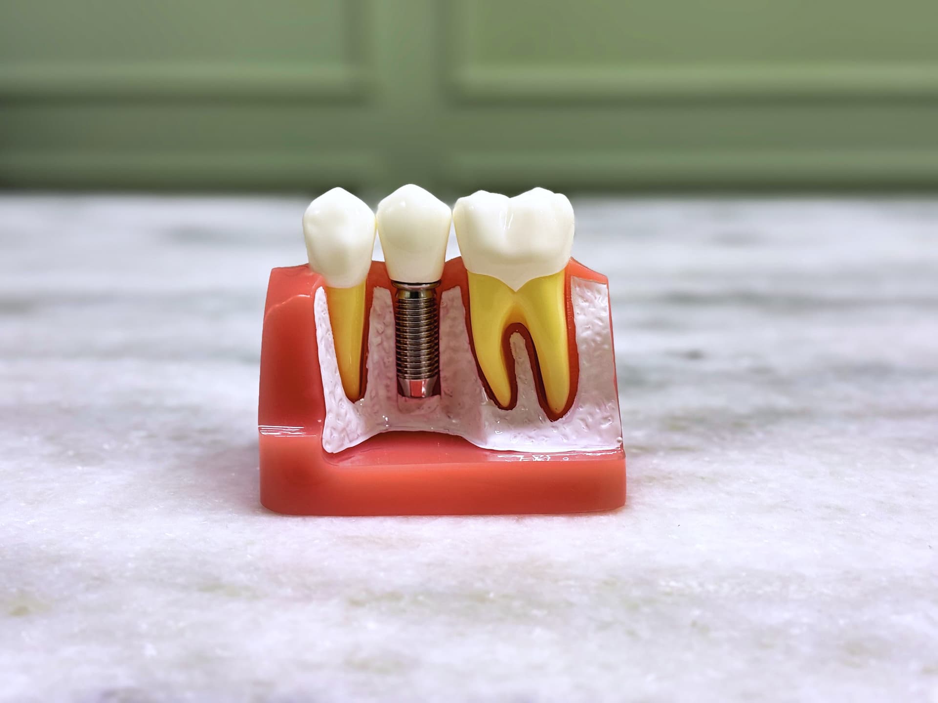 Tooth Side Section